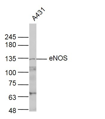 Anti-eNOS Polyclonal Antibody 2