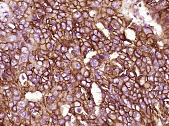 Anti-EpCAM Polyclonal Antibody 2