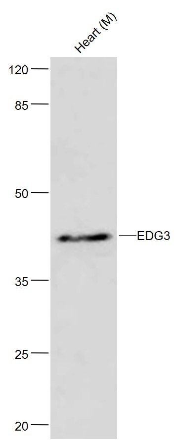 Anti-EDG3 Polyclonal Antibody