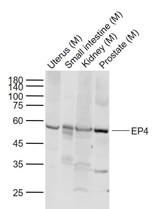 Anti-EP4 Polyclonal Antibody
