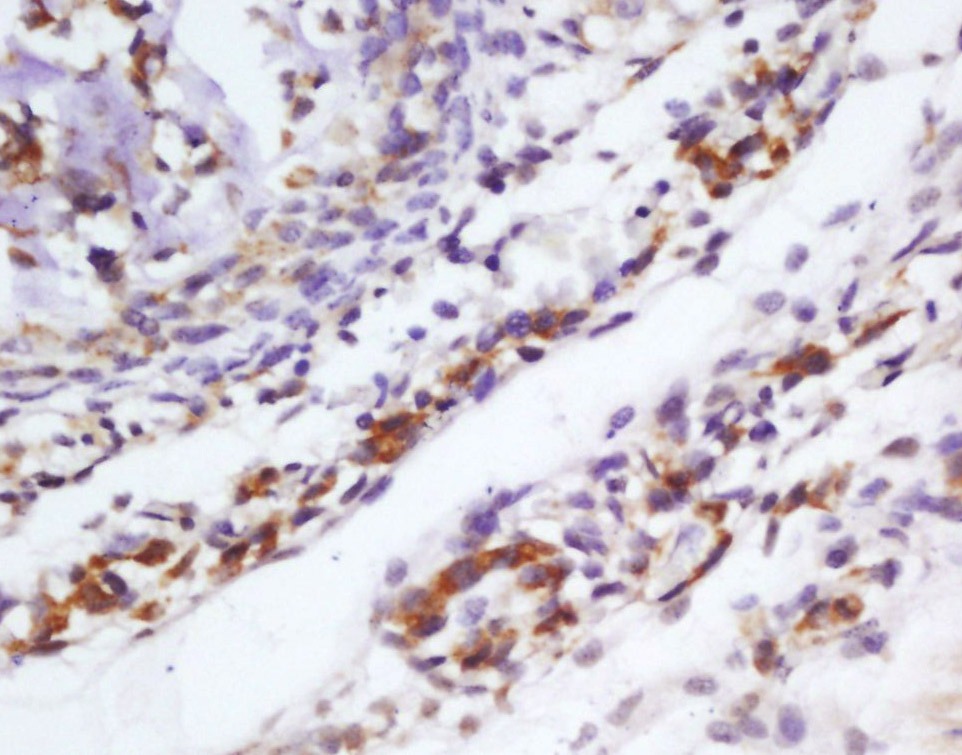Anti-EpCAM Polyclonal Antibody