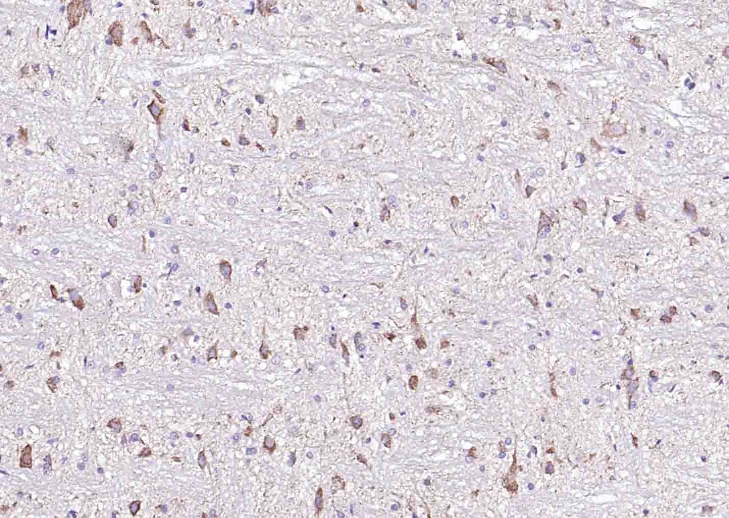 Anti-E-Cadherin/Cadherin-1 Polyclonal Antibody