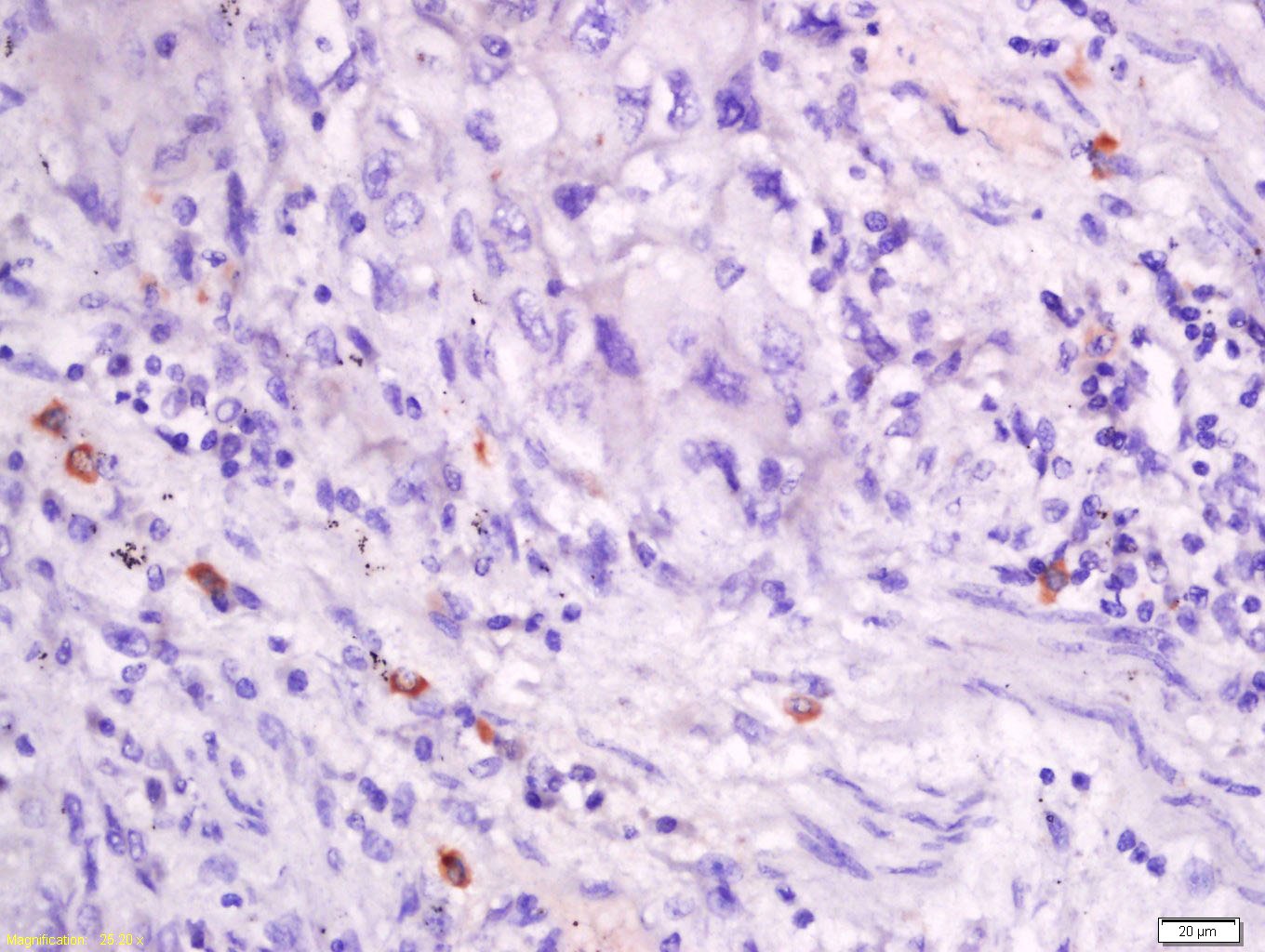 Anti-CXCL14 Polyclonal Antibody