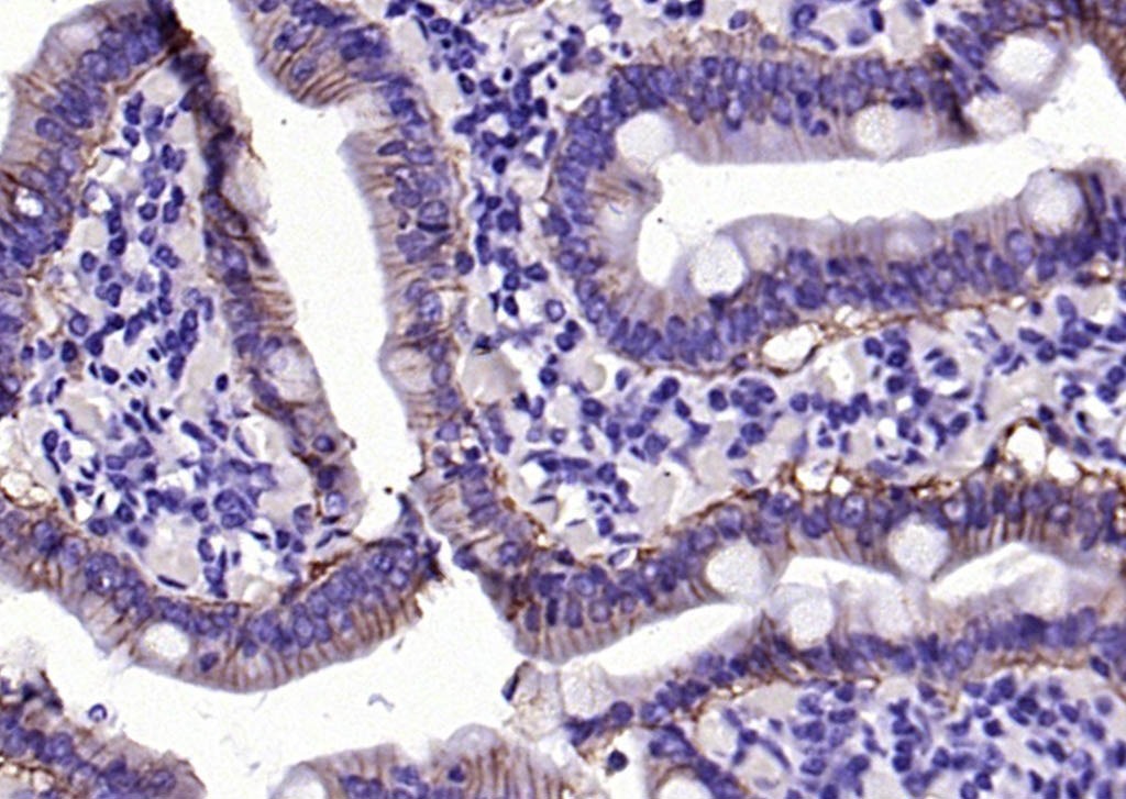 Anti-EpCAM Polyclonal Antibody 2