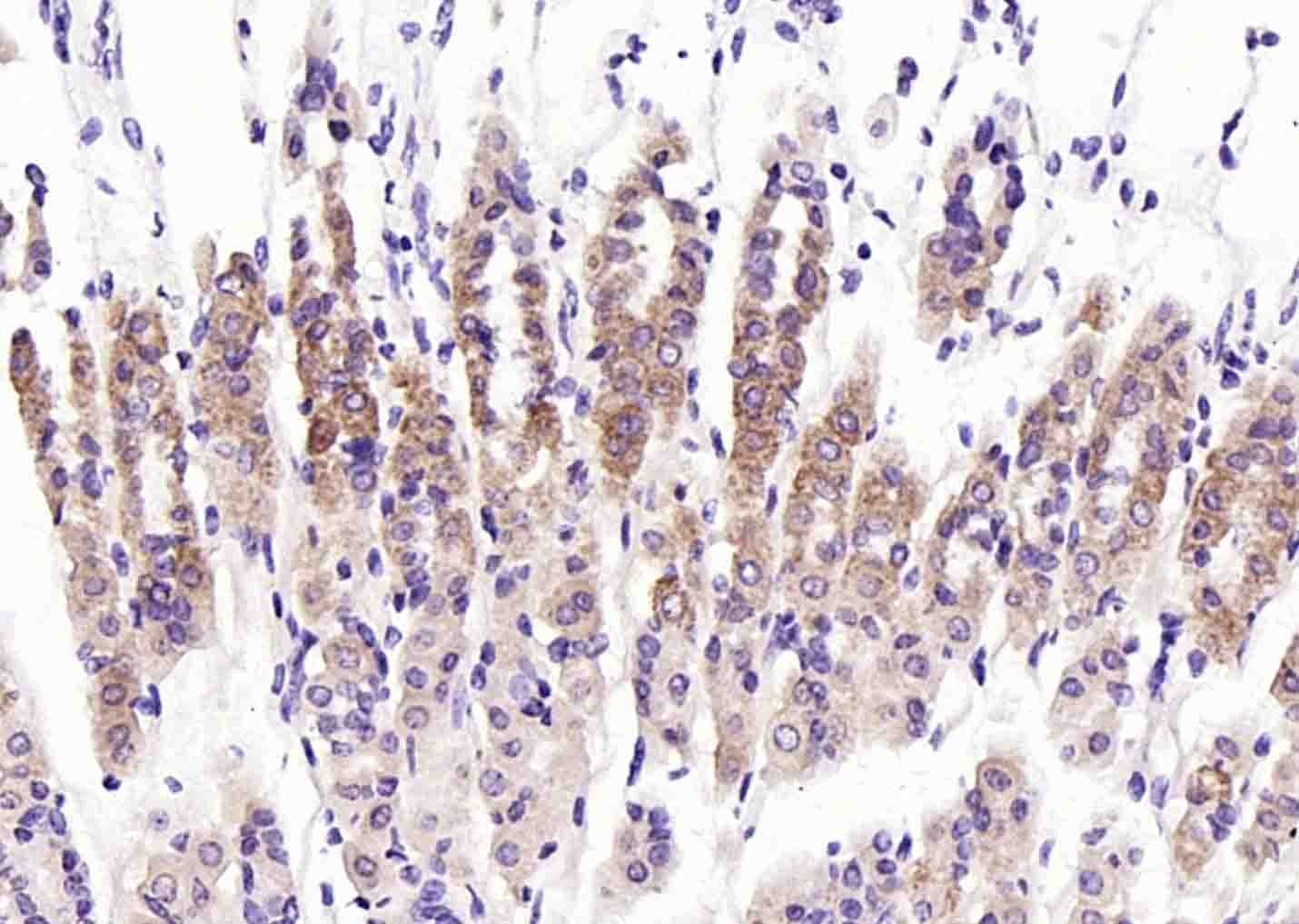 Anti-Eotaxin/CCL11 Polyclonal Antibody
