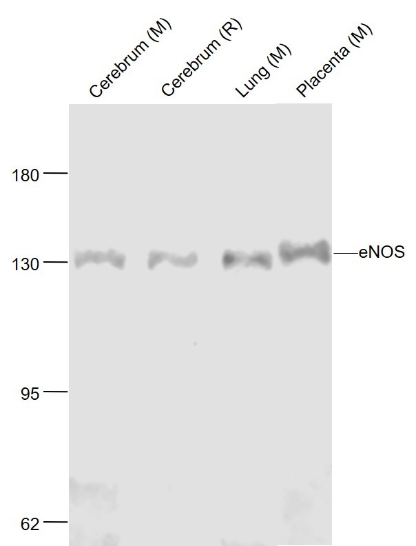 Anti-eNOS Antibody (6A162)