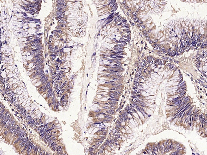 Anti-E-Cadherin/Cadherin-1 Polyclonal Antibody