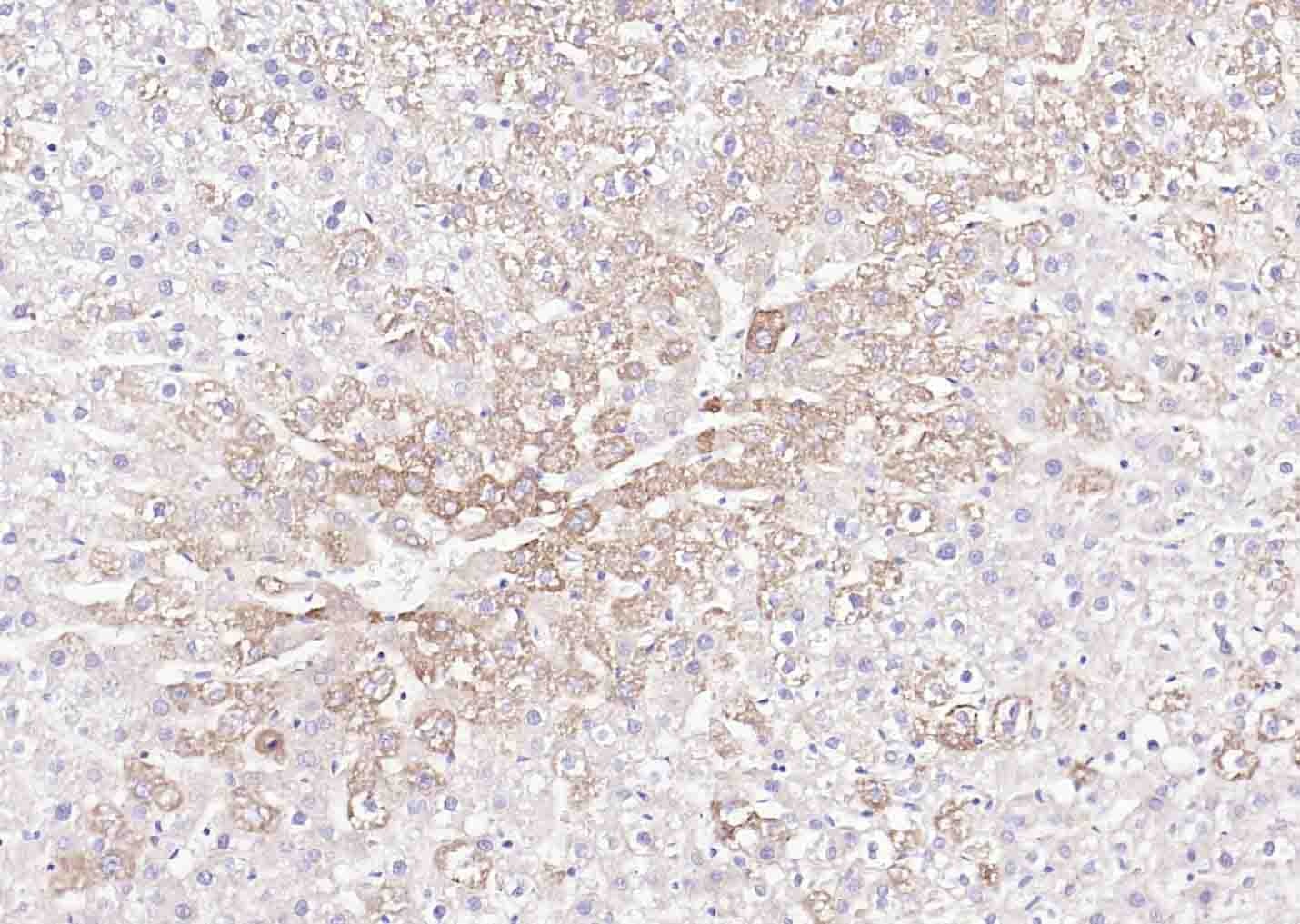 Anti-E-Cadherin/Cadherin-1 Polyclonal Antibody