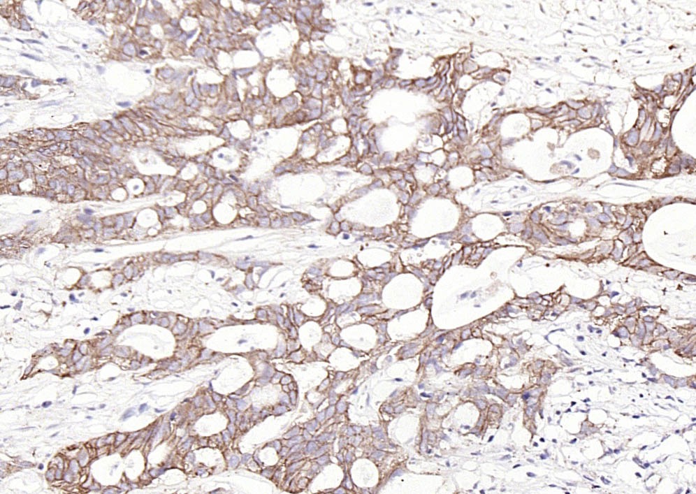 Anti-EpCAM Polyclonal Antibody 2
