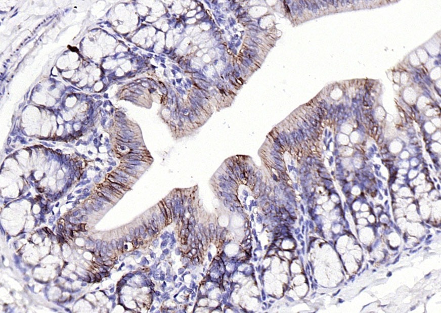 Anti-EpCAM Polyclonal Antibody 2
