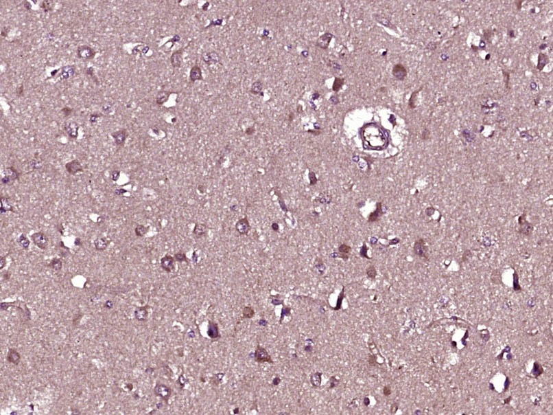Anti-EDG1 Polyclonal Antibody