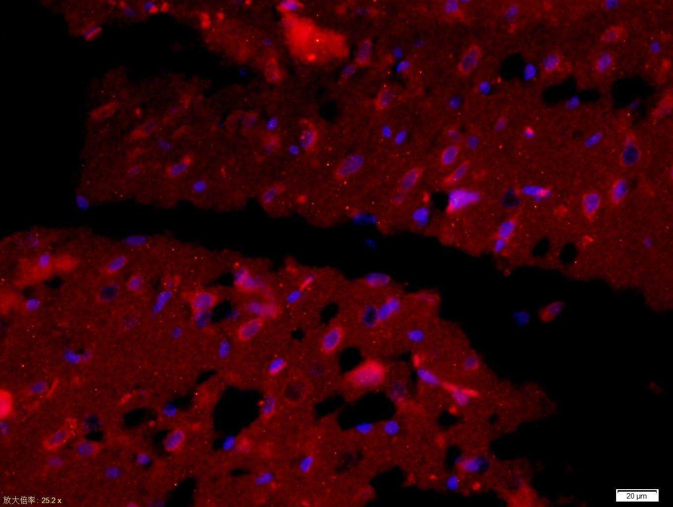 Anti-ENO1 Polyclonal Antibody