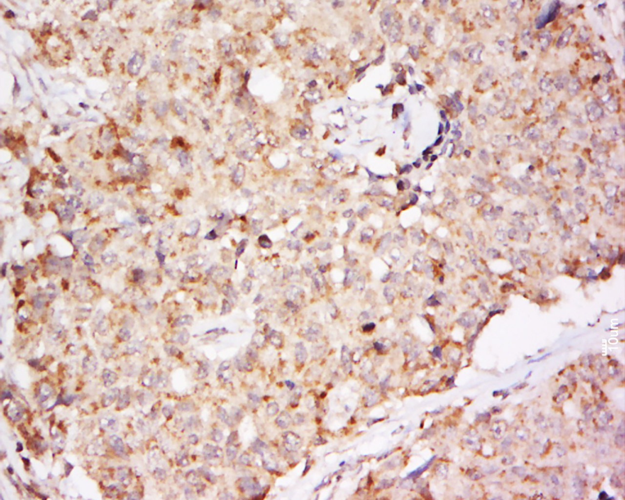 Anti-EphB2 Polyclonal Antibody