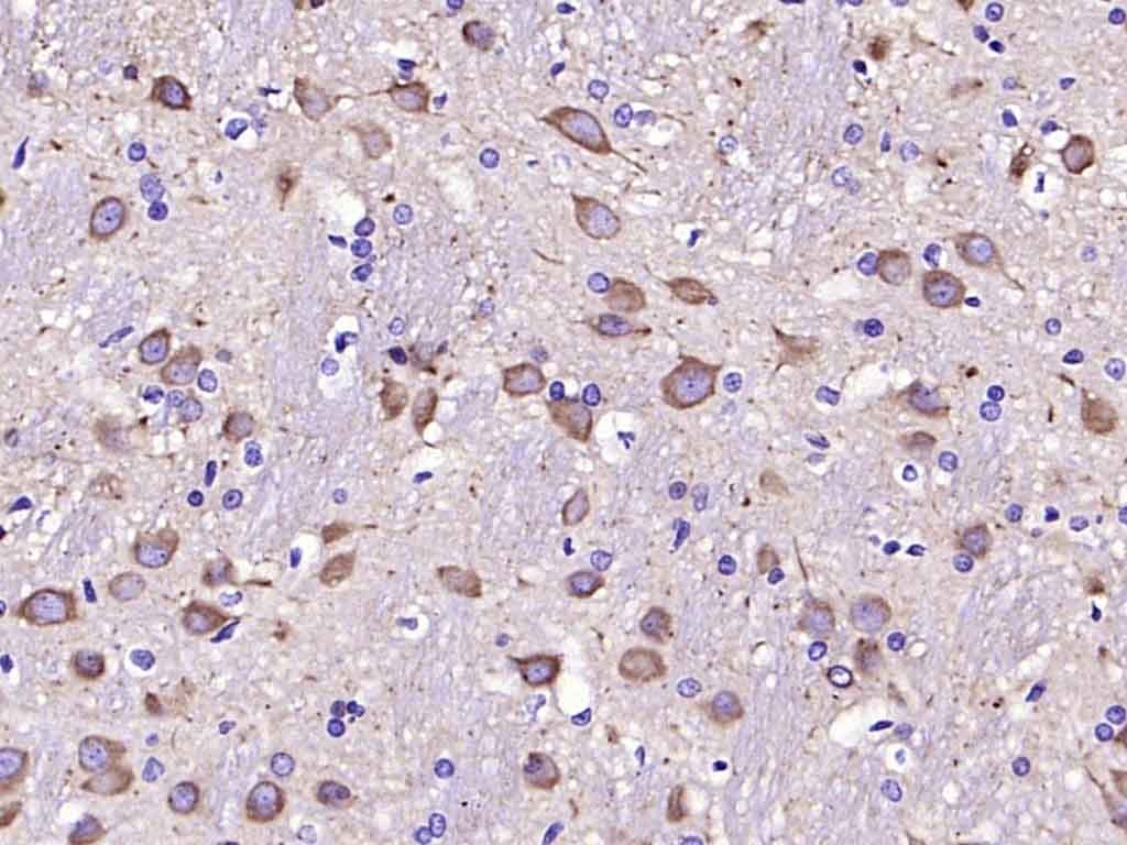 Anti-Ephrin B2/EFNB2 Antibody (6Q379)