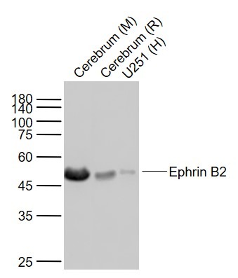 Anti-Ephrin B2/EFNB2 Antibody (6Q379)
