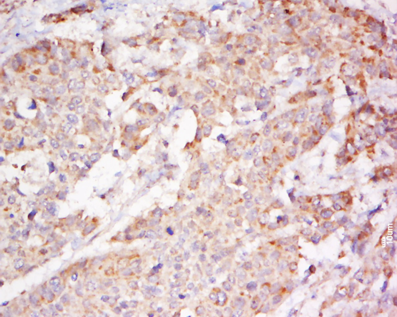 Anti-EphB2 Polyclonal Antibody