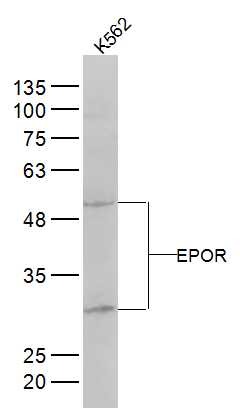Anti-EPOR Polyclonal Antibody