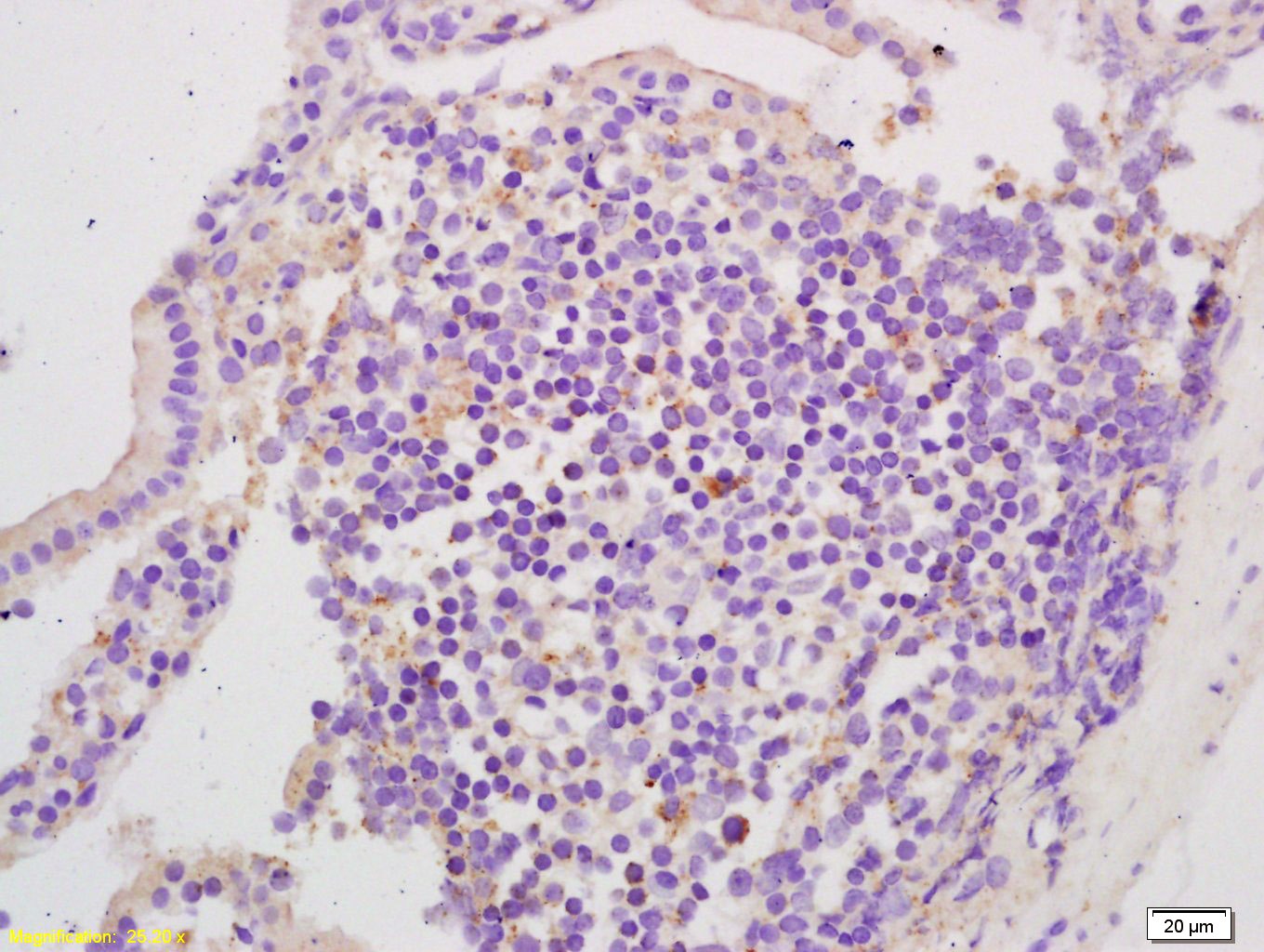 Anti-EphA2 Polyclonal Antibody
