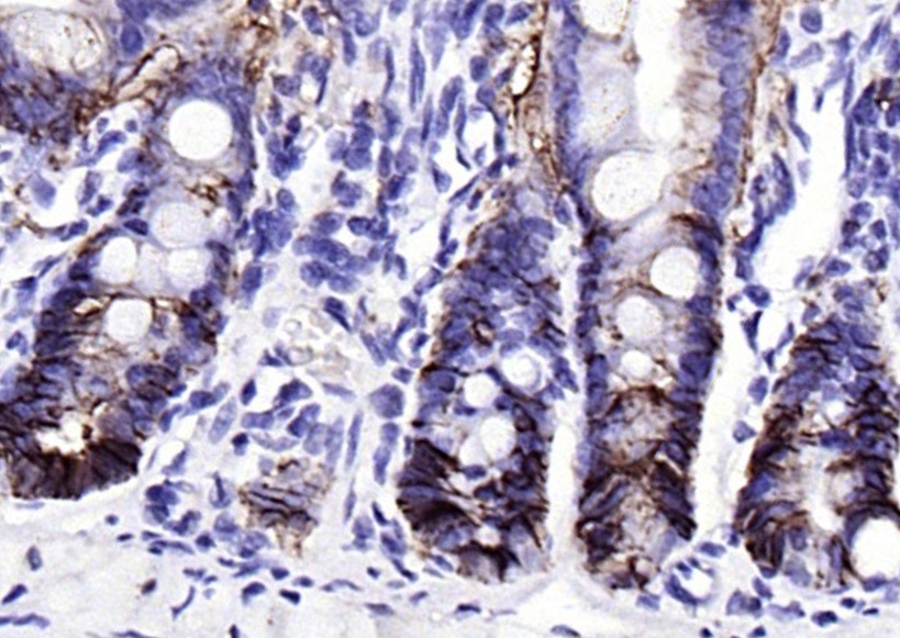 Anti-EpCAM Polyclonal Antibody 2