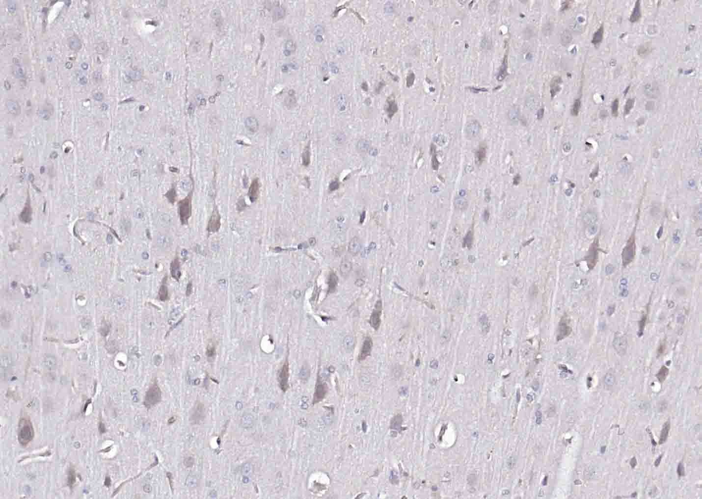 Anti-Beta-Amyloid 1-42 Antibody (2D185)