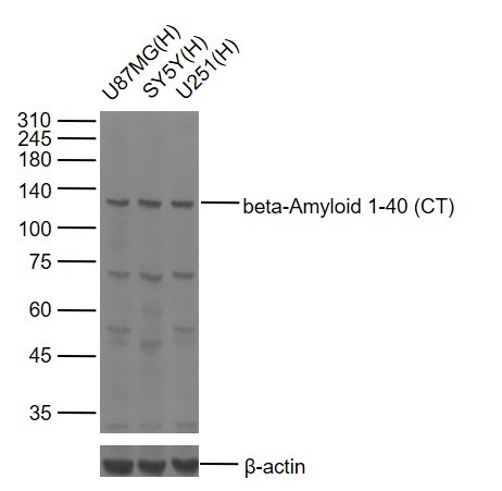 Anti-Beta-Amyloid 1-40 (CT) Polyclonal Antibody