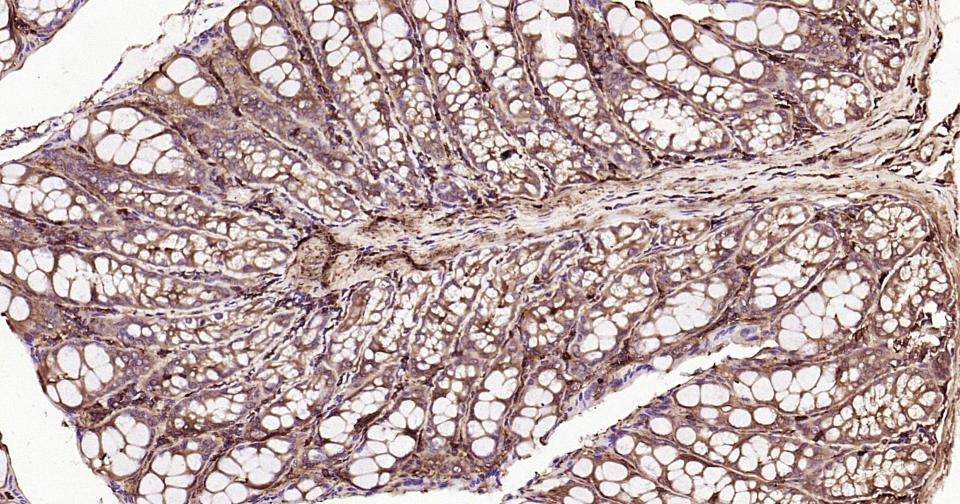 Beta-Actin Loading Control Polyclonal Antibody