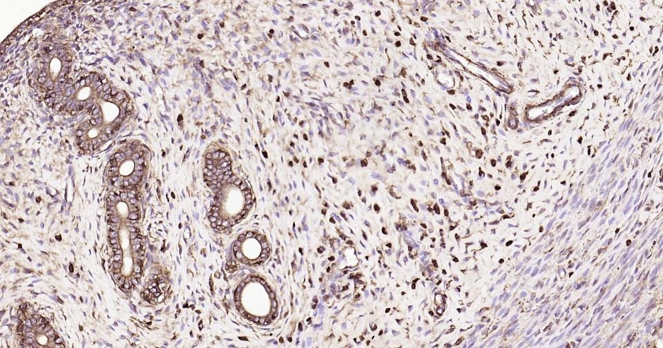 Beta-Actin Loading Control Polyclonal Antibody