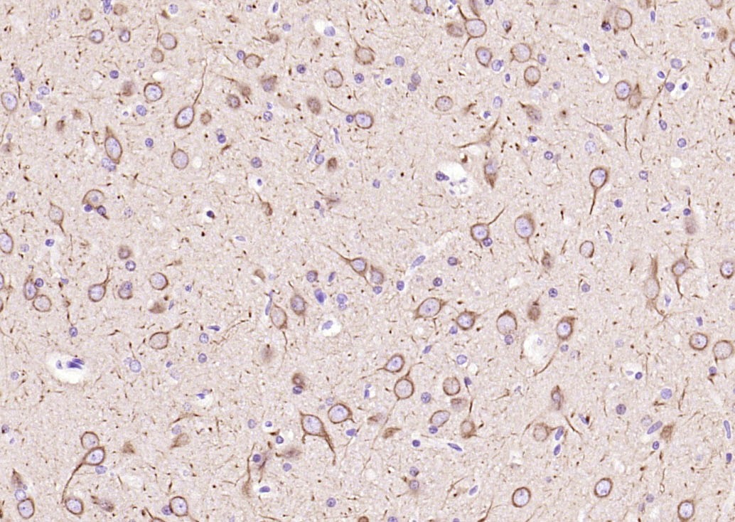 Beta-Tubulin Loading Control Antibody (8M945)