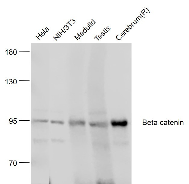 Anti-Beta-Catenin Antibody (5O621)