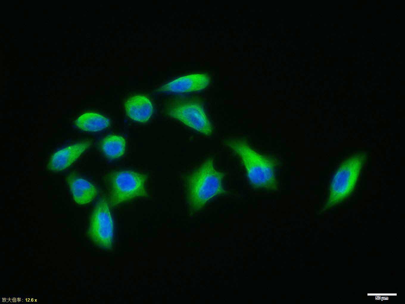 Beta-Tubulin Loading Control Antibody (8M945)