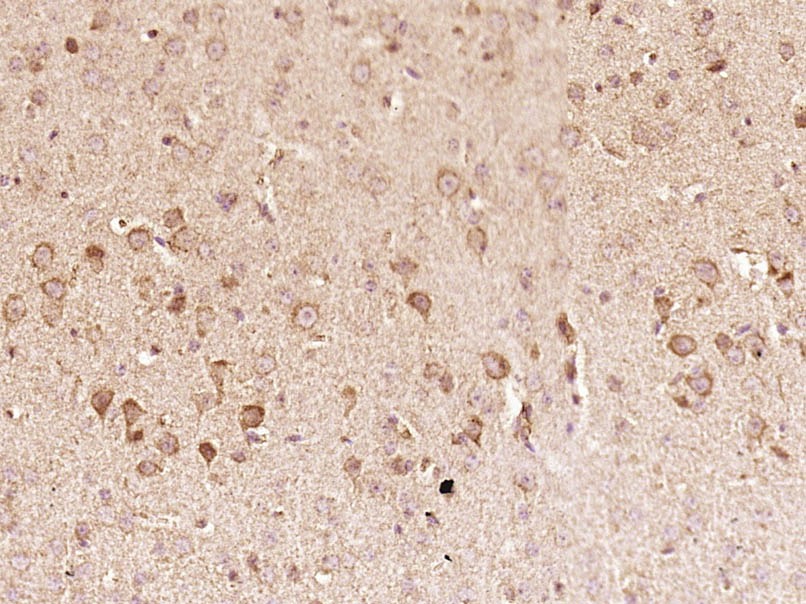 Anti-CCL5 Polyclonal Antibody 2