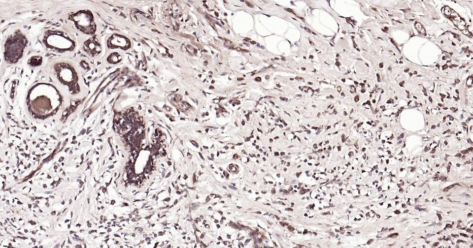 Beta-Tubulin Loading Control Polyclonal Antibody