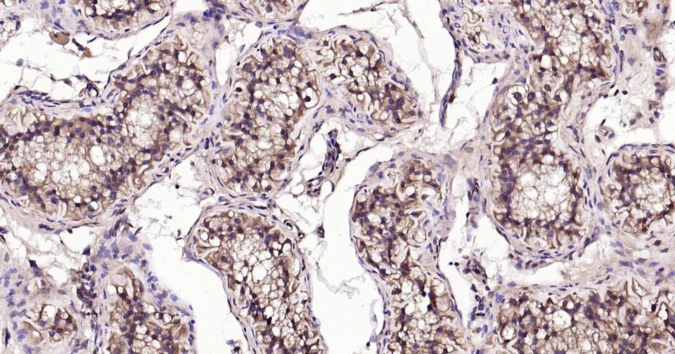 Beta-Tubulin Loading Control Polyclonal Antibody