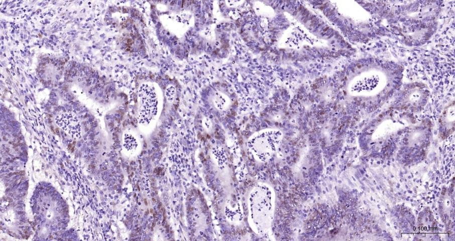 Anti-CCND1 Polyclonal Antibody