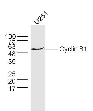 Anti-CCNB1 Polyclonal Antibody
