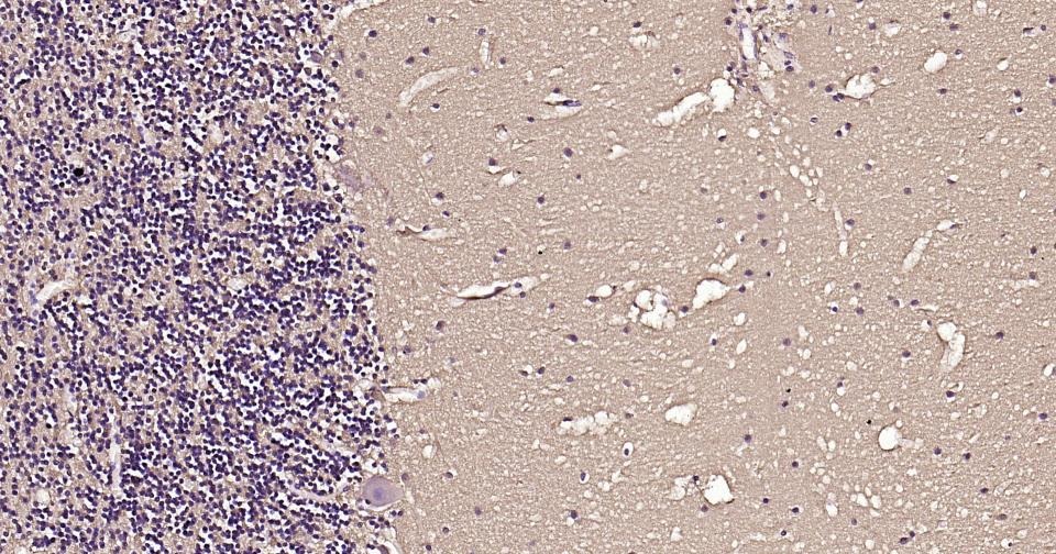 Beta-Tubulin Loading Control Antibody (1L64)