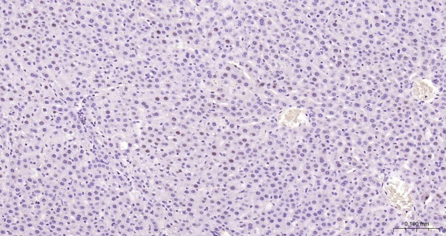 Anti-CCND1 Polyclonal Antibody