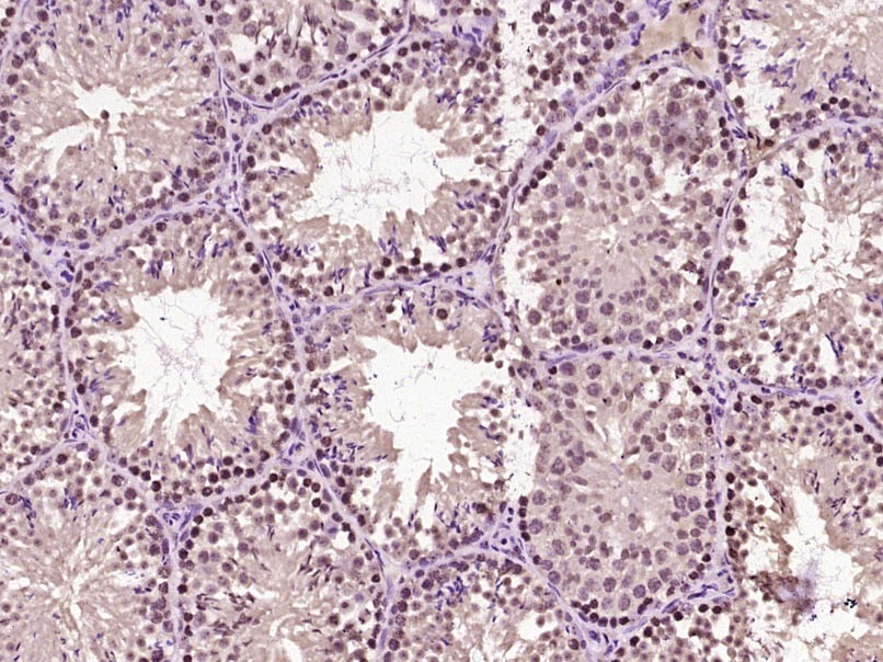 Anti-Beta-Catenin Polyclonal Antibody 2
