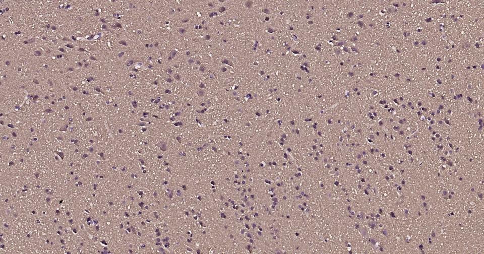 Beta-Tubulin Loading Control Antibody (1L64)
