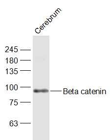 Anti-Beta-Catenin Polyclonal Antibody 2