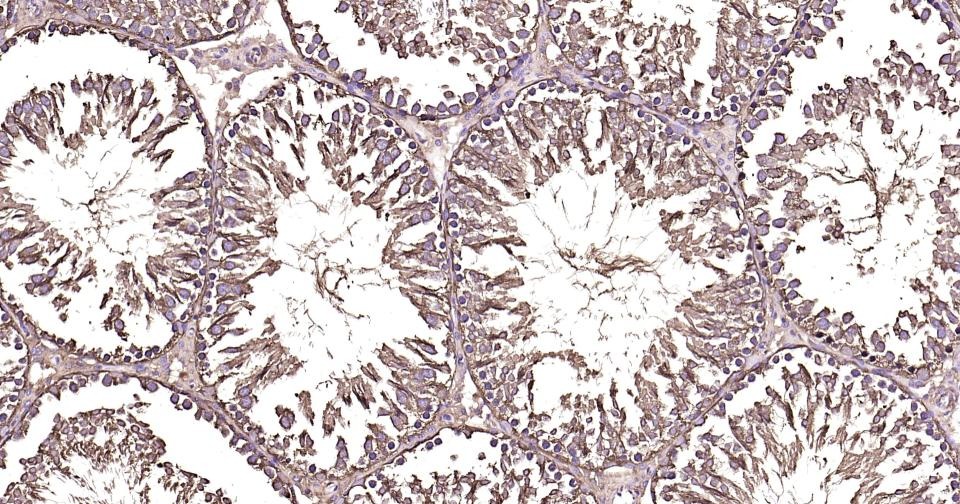 Beta-Tubulin Loading Control Antibody (1L64)