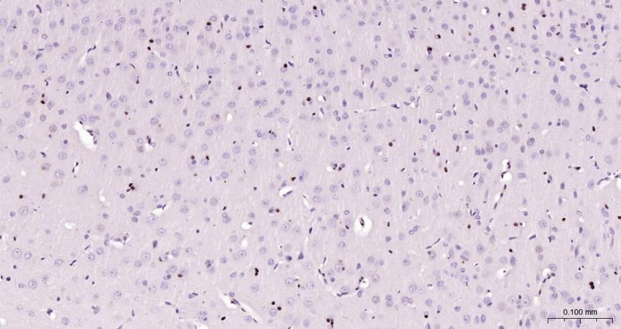 Anti-CCND1 Polyclonal Antibody