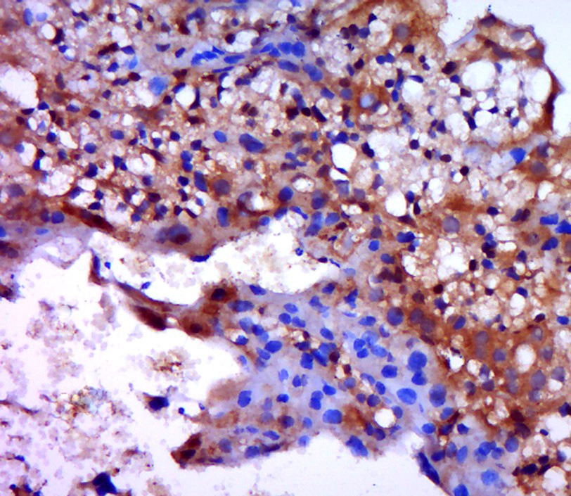 Anti-Beta-Catenin Polyclonal Antibody