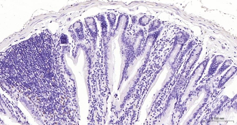 Anti-CCND1 Polyclonal Antibody