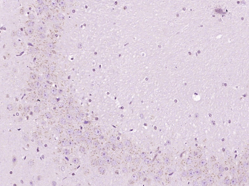 Anti-Beta-Catenin Polyclonal Antibody 2