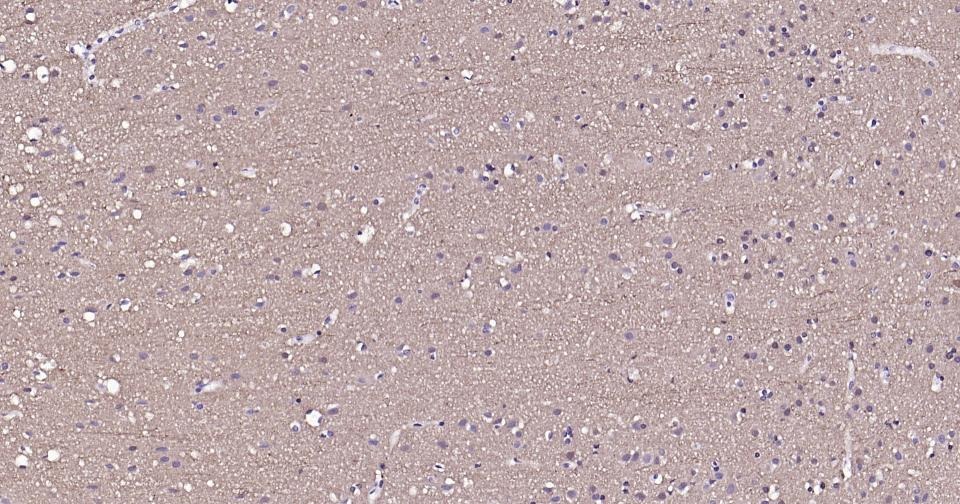 Beta-Tubulin Loading Control Antibody (8M945)