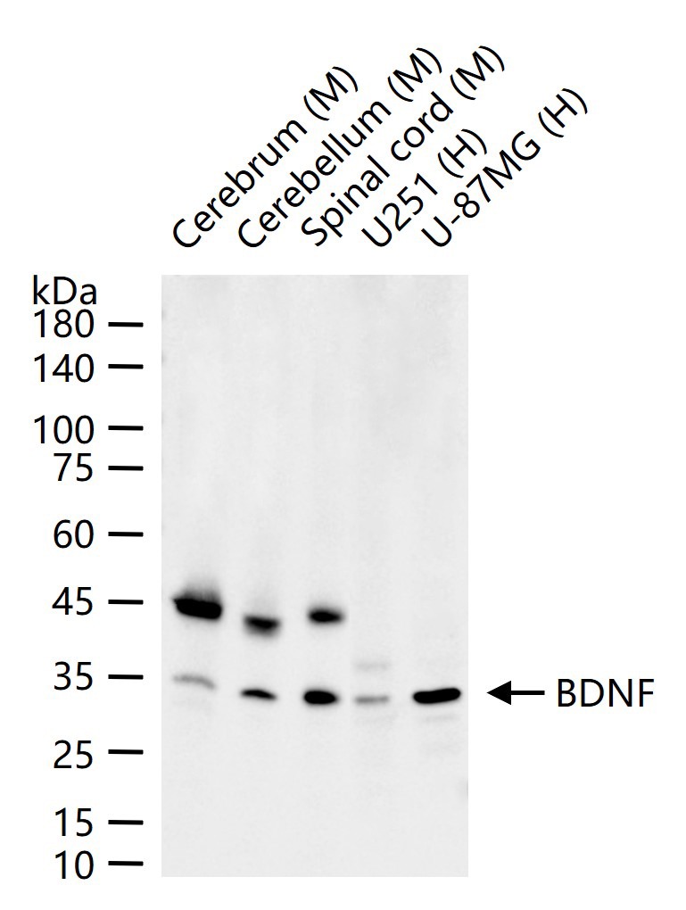 Anti-BDNF Antibody (1R78)
