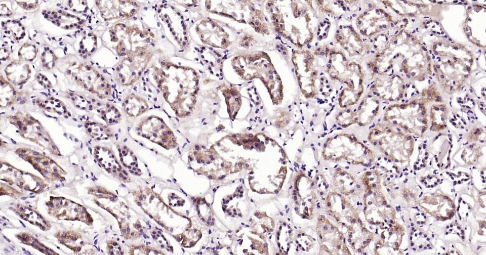 Anti-Beclin-1 Antibody (8U829)