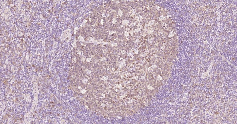Anti-Caspase-3 Antibody (2P196)