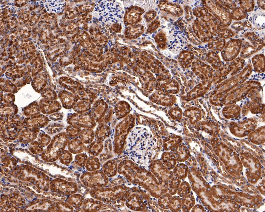 Anti-BCL2A1 Antibody (2U316)